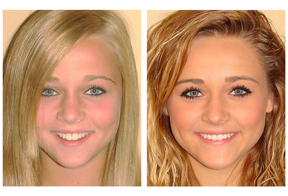 Venice Advanced Dentistry