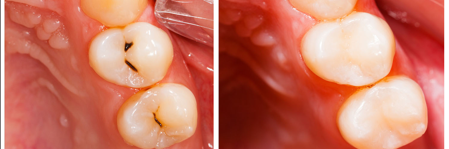 Venice Advanced Dentistry